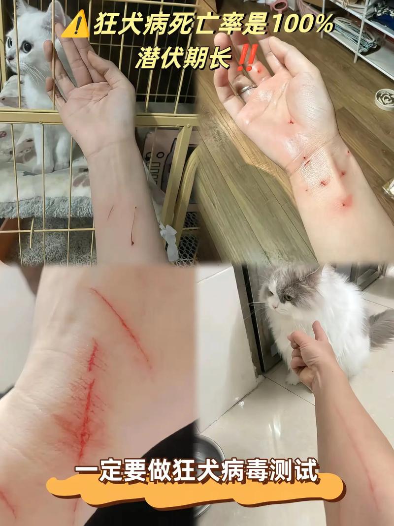 被猫咬和被猫抓哪个更严重,猫抓咬伤不同,及时处理打疫苗很重要 被猫咬和被猫抓哪个更严重,猫抓咬伤不同,及时处理打疫苗很重要