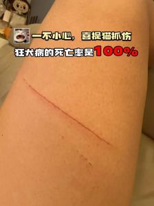被猫咬2年了还有潜伏期吗，猫咬两年后，狂犬病无忧，破伤风需打针