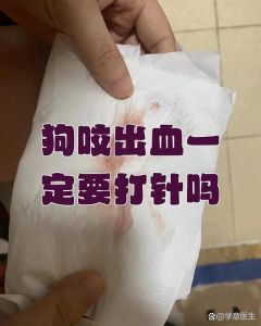 被家养的狗咬了出血要打针吗，狗咬伤流血要不要打疫苗？速去医院看医生！