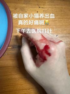 被家养猫咬了出血了会怎么样，猫咬出血要当心，速处理防感染！