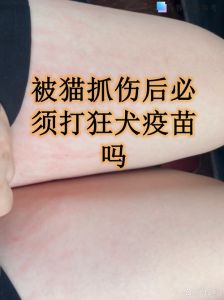 被自家猫抓伤要打针不，猫抓伤要不要打疫苗？看情况！