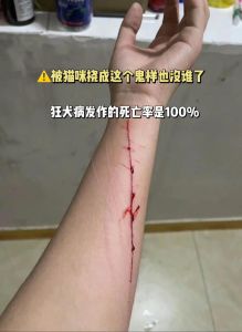 被家养猫抓伤出血要打针吗，猫抓伤流血，自家猫健康不用慌，伤口冲洗消毒最重要